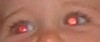 Original red eye